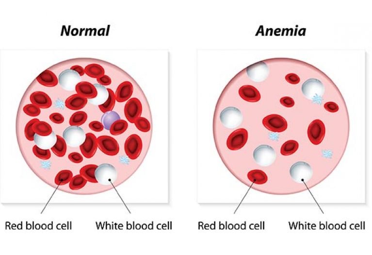 Things Everyone Knows About How to Treat Anemia in Dogs That You Don't